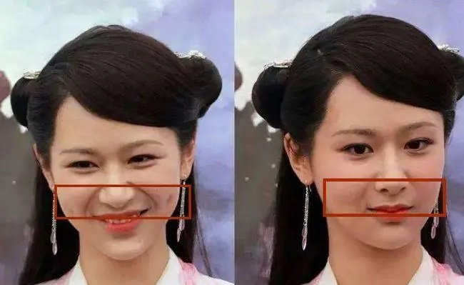 解决法令纹还得靠它