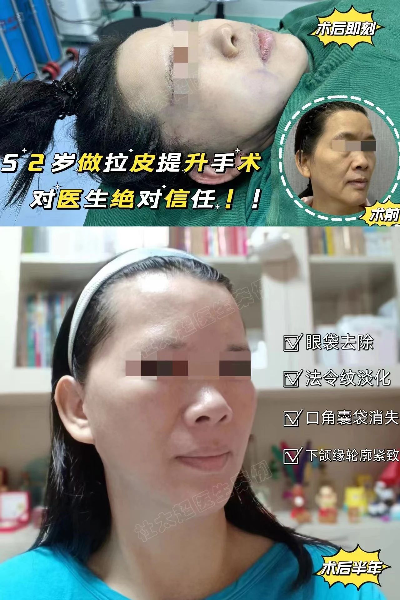 52岁的我通过亲身经历，分享拉皮和切眉手术的全过程！