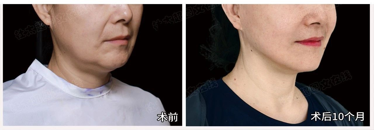 1754561456195853.jpg 微信图片_2025-08-07_180809_800.jpg