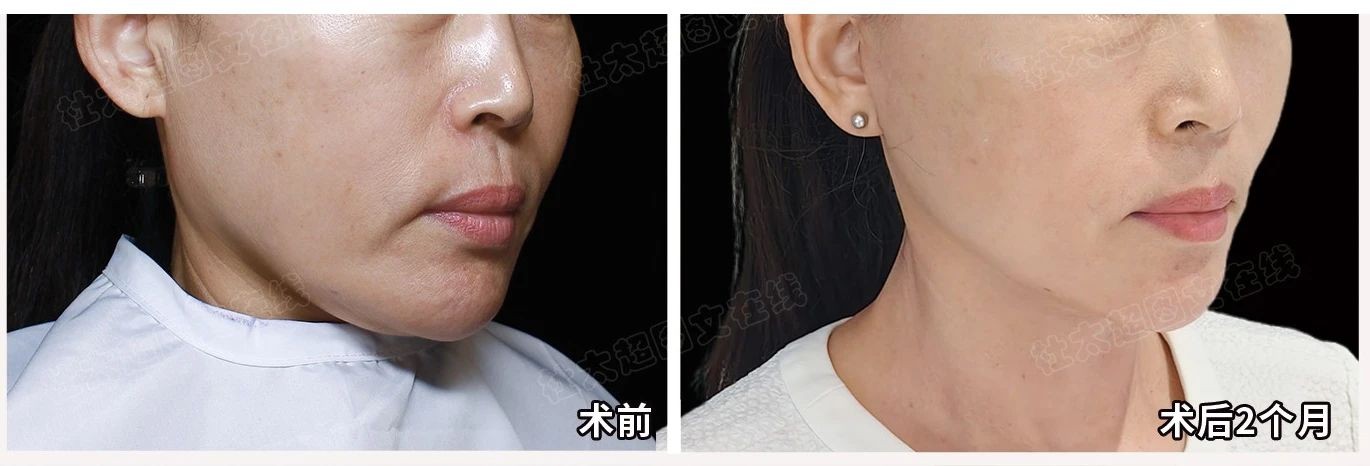 1754990997153145.jpg 微信图片_2025-08-12_173125_842.jpg