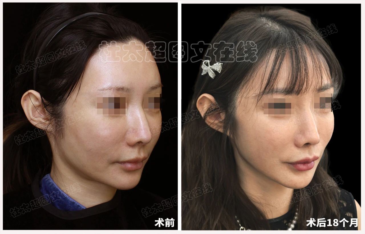 1755169427147748.jpg 微信图片_2025-08-14_190059_721.jpg