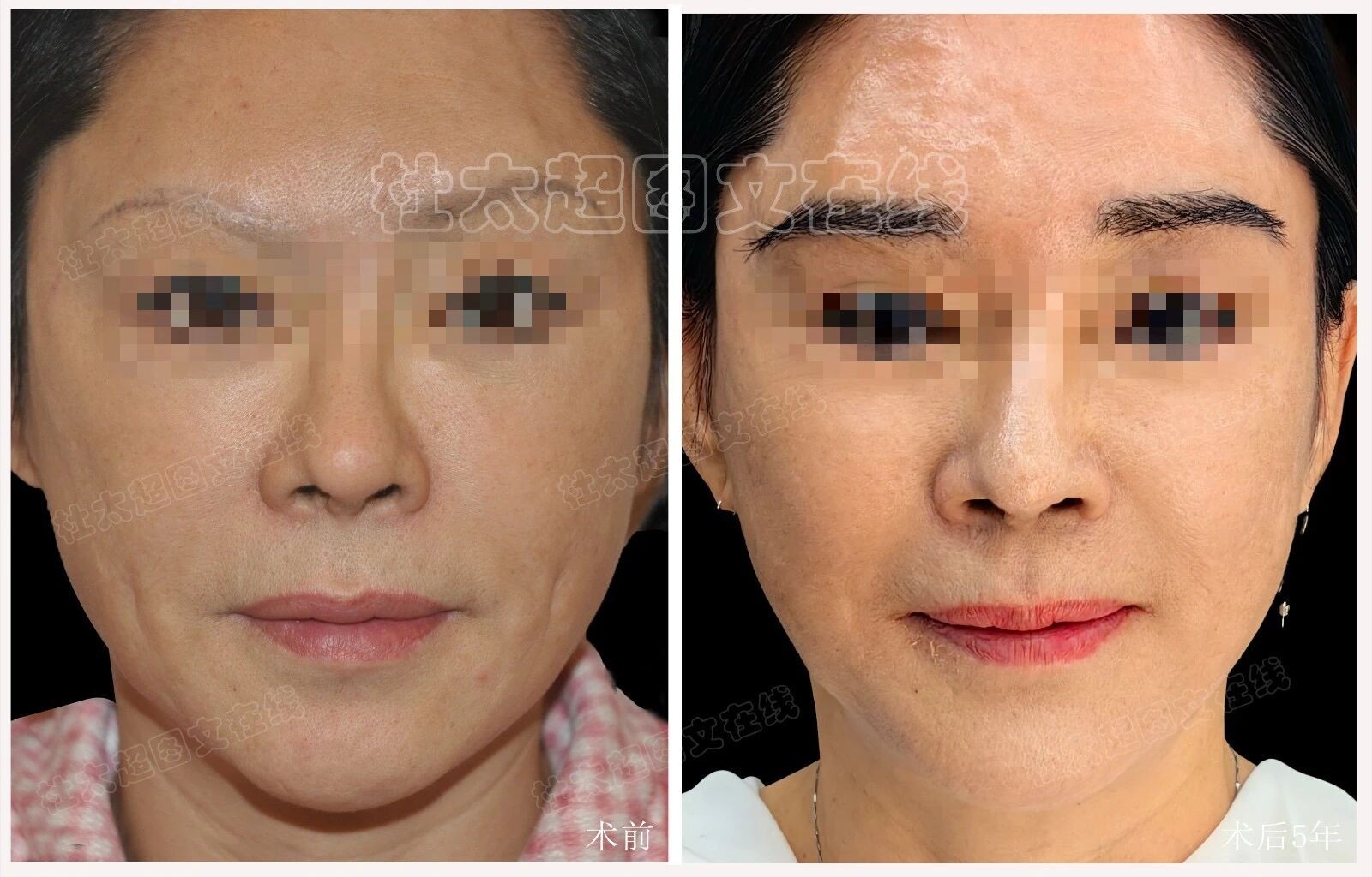 1756807296208870.jpg 微信图片_2025-09-02_174517_211.jpg