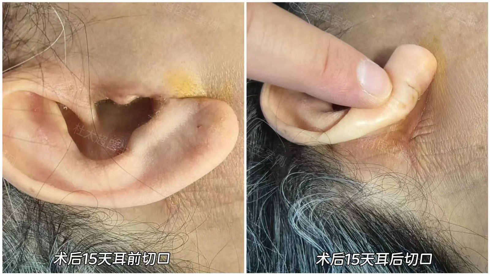 1757298466177555.jpg 微信图片_2025-09-08_102301_035.jpg