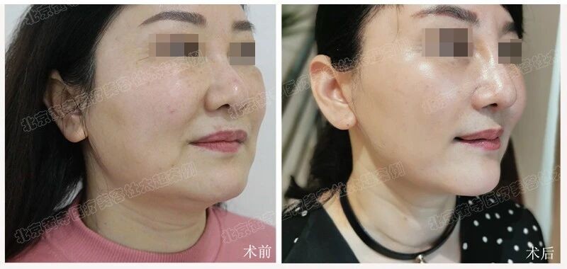 1757327055200896.jpg 微信图片_2025-09-08_182032_809.jpg