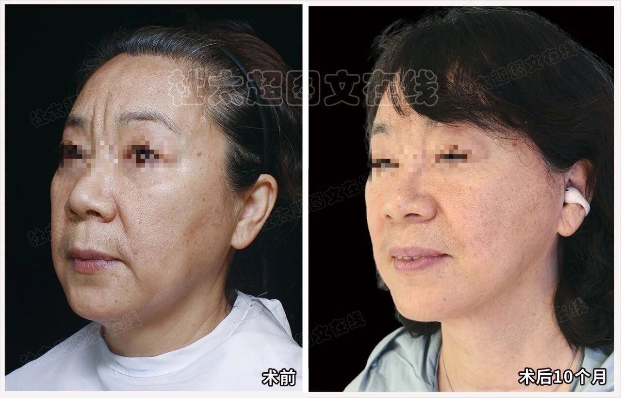 1757496561140064.jpg 微信图片_2025-09-10_172557_751.jpg