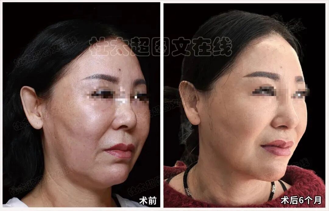 1758107040187379.jpg 微信图片_2025-09-17_190100_084.jpg