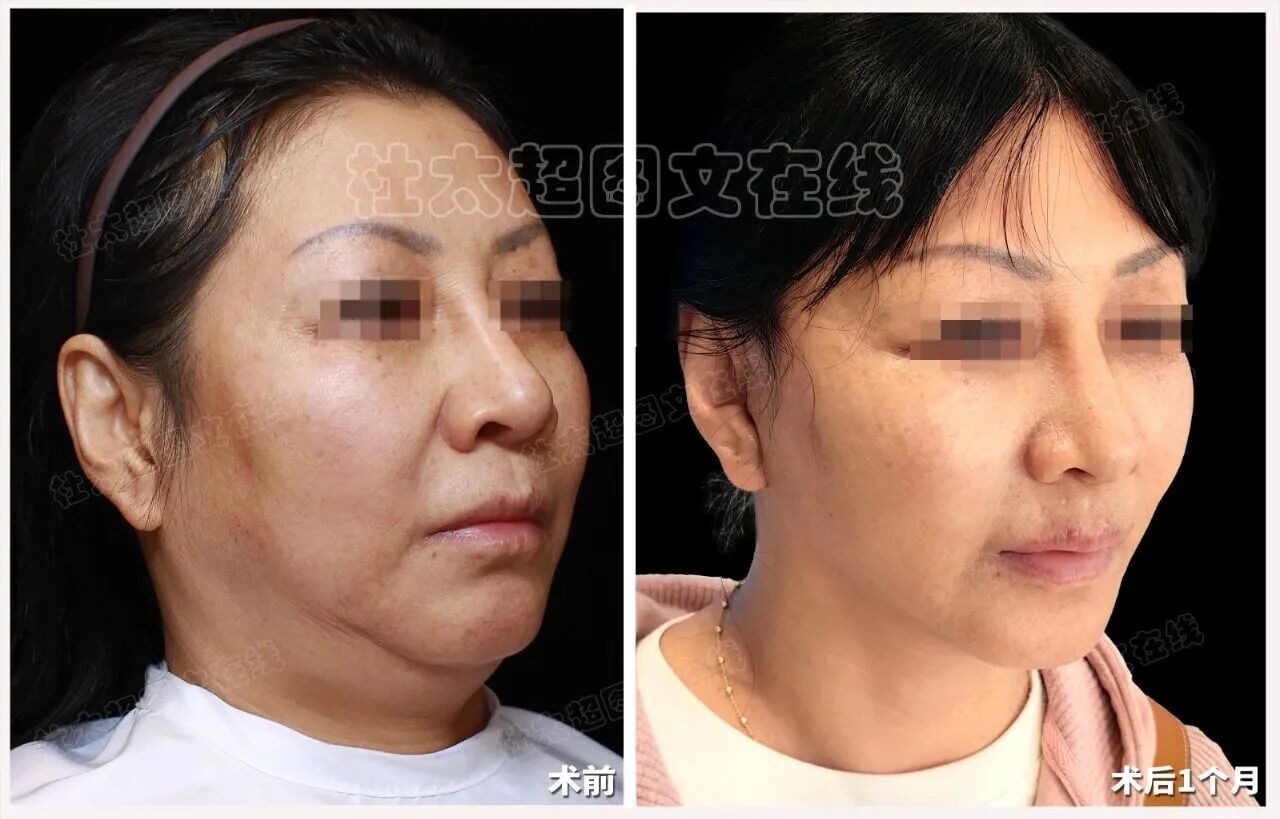 1758704852658208.jpg 微信图片_2025-09-24_170446_518.jpg