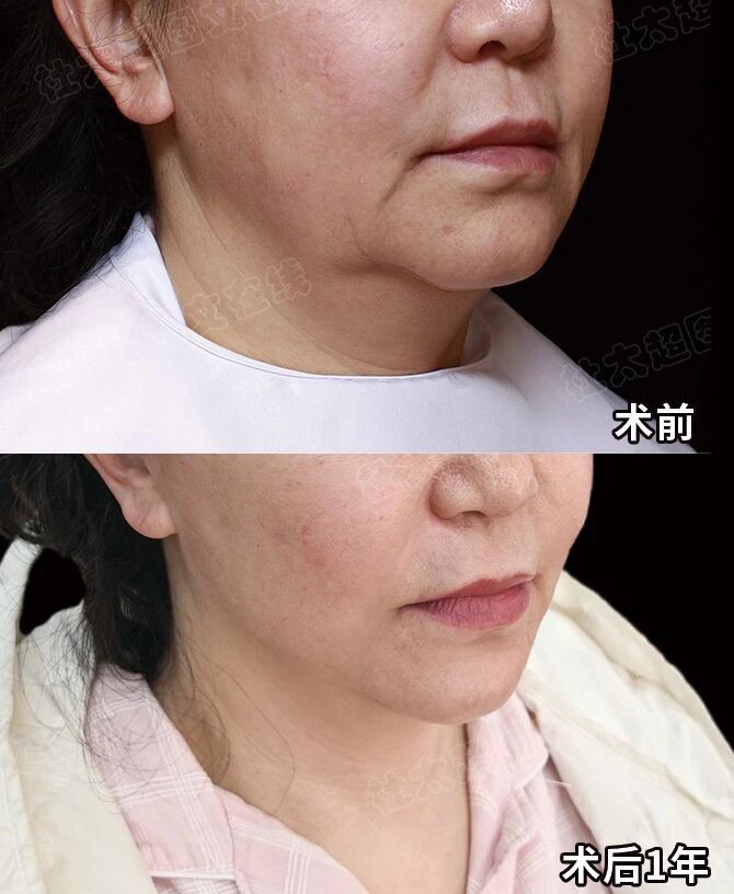 1759383297108149.jpg 微信图片_2025-10-02_133129_135.jpg